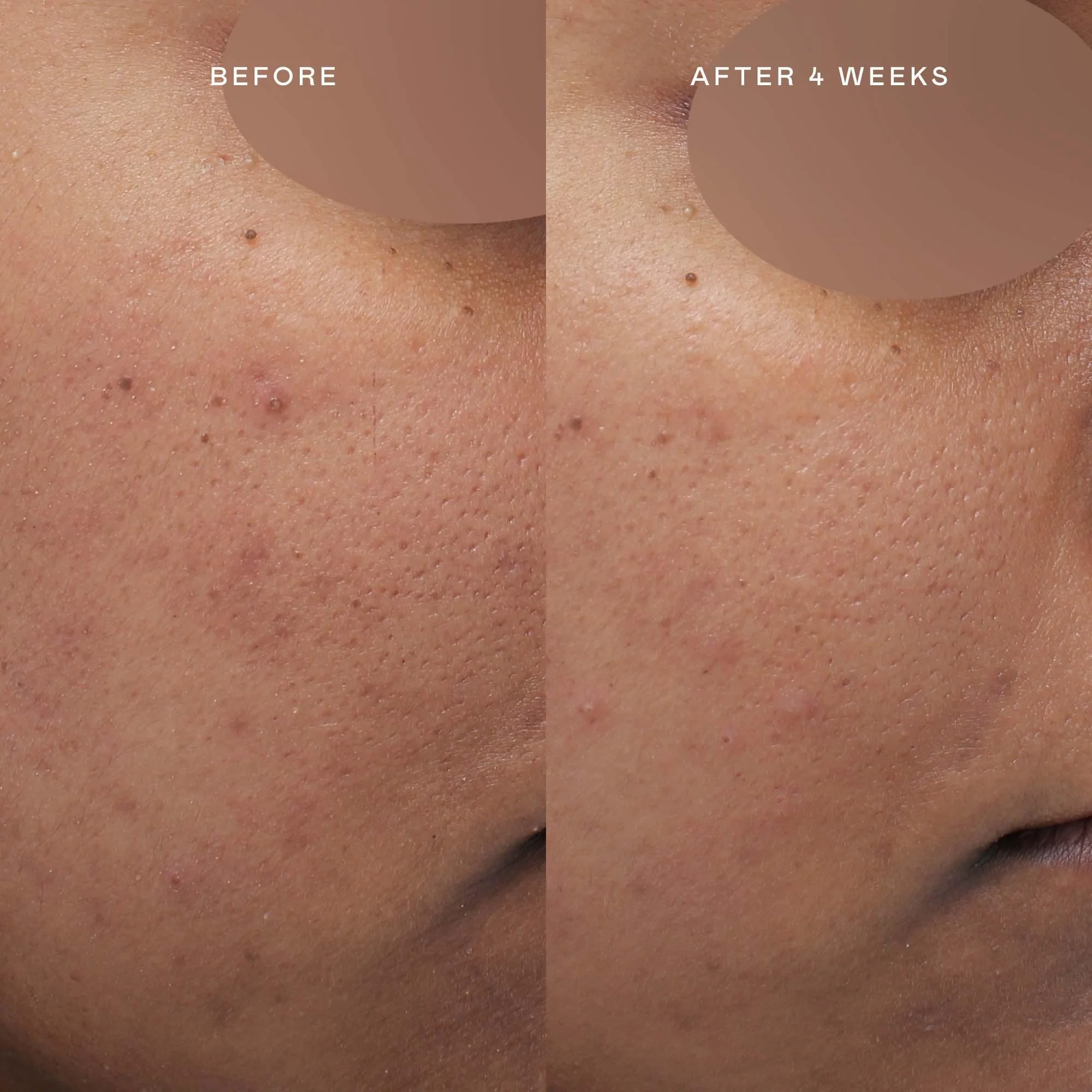 The Brighter Not Lighter Trio - Image 4