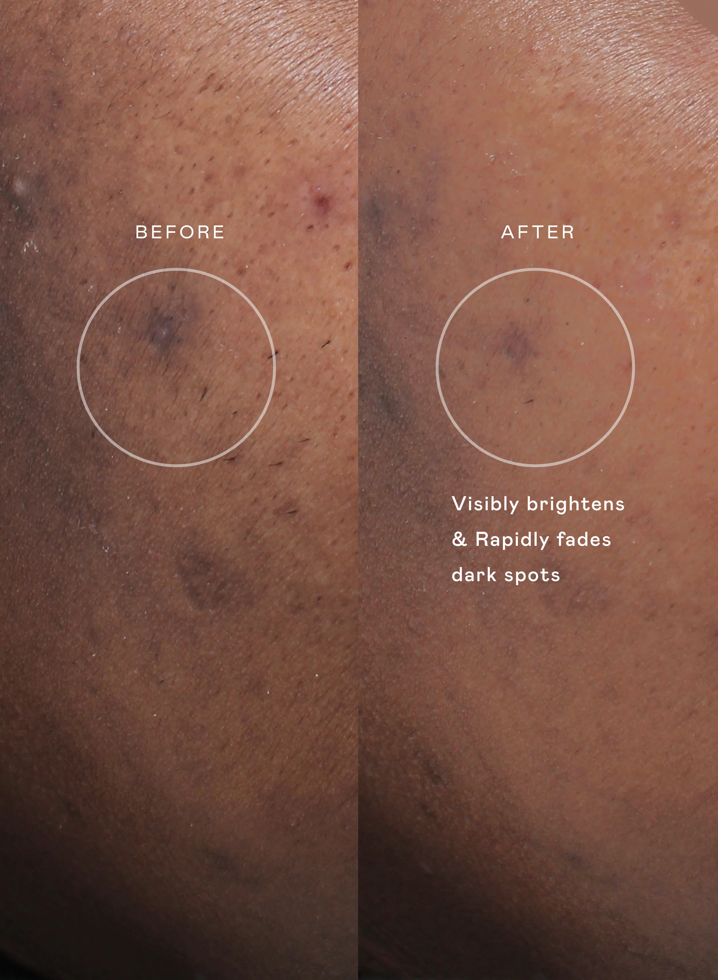 The Even Skin Set - Image 3